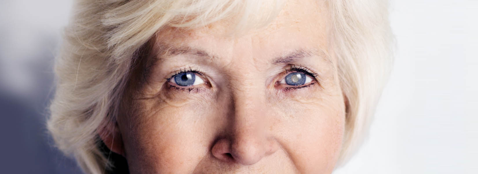 Cataract Surgery in Lacey
